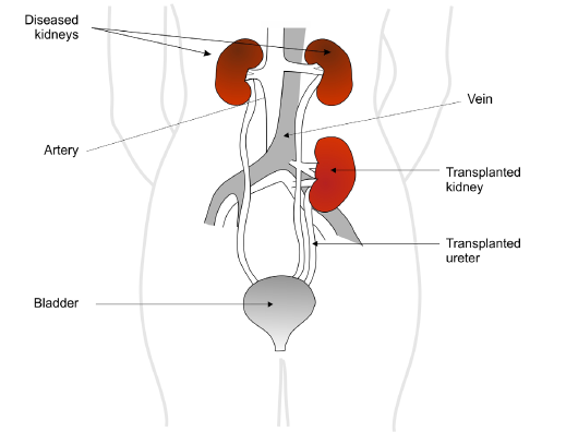 Pediatric Urologist Hospital in Ahmedabad  
